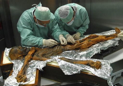 (Marco Samadelli/Eurac/South Tyrol Museum of Archaeology via AP). In this November 2010 photo provided by the South Tyrol Museum of Archaeology, researchers examine the body of a frozen hunter known as Oetzi the Iceman to sample his stomach contents in... (Marco Samadelli/Eurac/South Tyrol Museum of Archaeology via AP). In this November 2010 photo provided by the South Tyrol Museum of Archaeology, researchers examine the body of a frozen hunter known as Oetzi the Iceman to sample his stomach contents in...