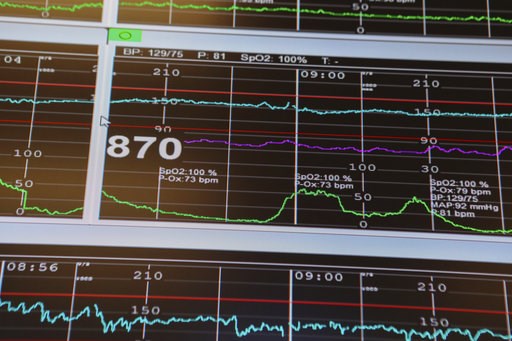 (AP Photo/Teresa Crawford). This Aug. 7, 2018 photo shows the screen of a fetal monitor at a hospital in Chicago. According to a study released on Wednesday, Aug. 8, 2018, first-time mothers at low risk of complications were less likely to need a cesar... (AP Photo/Teresa Crawford). This Aug. 7, 2018 photo shows the screen of a fetal monitor at a hospital in Chicago. According to a study released on Wednesday, Aug. 8, 2018, first-time mothers at low risk of complications were less likely to need a cesar...
