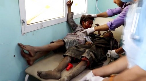 (AP Video via AP). This image made from video taken on Thursday, Aug. 9, 2018, shows a child injured in an airstrike being treated at a hospital in Saada, Yemen. Yemen's Shiite rebels are backing a United Nations' call for an investigation into a Saudi... (AP Video via AP). This image made from video taken on Thursday, Aug. 9, 2018, shows a child injured in an airstrike being treated at a hospital in Saada, Yemen. Yemen's Shiite rebels are backing a United Nations' call for an investigation into a Saudi...