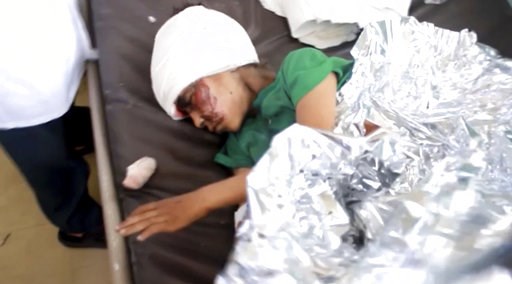 (AP Video via AP). This image made from video taken on Thursday, Aug. 9, 2018, shows a child injured in an airstrike resting at a hospital in Saada, Yemen. Yemen's Shiite rebels are backing a United Nations' call for an investigation into a Saudi-led c... (AP Video via AP). This image made from video taken on Thursday, Aug. 9, 2018, shows a child injured in an airstrike resting at a hospital in Saada, Yemen. Yemen's Shiite rebels are backing a United Nations' call for an investigation into a Saudi-led c...