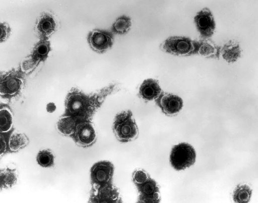 (Dr. Erskine Palmer/CDC via AP). This 1981 electron microscope image made available by the Centers for Disease Control and Prevention shows varicella-zoster virions from a patient with chickenpox. On Thursday, Oct. 11, 2018, the CDC says a small but gr...