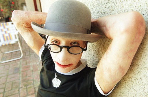 Dave Dave, who was set afire as boy, died of natural causes