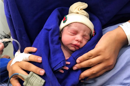 (Courtesy Dr. Wellington Andraus via AP). This Dec. 15, 2017 photo provided by transplant surgeon Dr. Wellington Andraus shows the baby girl born to a woman with a uterus transplanted from a deceased donor at the Hospital das Clinicas of the University... (Courtesy Dr. Wellington Andraus via AP). This Dec. 15, 2017 photo provided by transplant surgeon Dr. Wellington Andraus shows the baby girl born to a woman with a uterus transplanted from a deceased donor at the Hospital das Clinicas of the University...