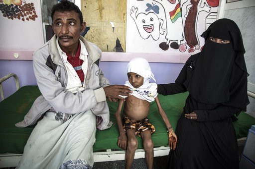 UN says civilian casualties in Yemen average 123 per week